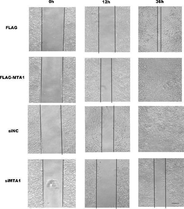 MTA1 promotes A498 cell migration