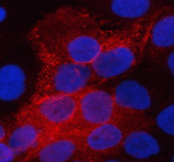 pa1488 aqp3 primary antibodies if testing 6_1_1