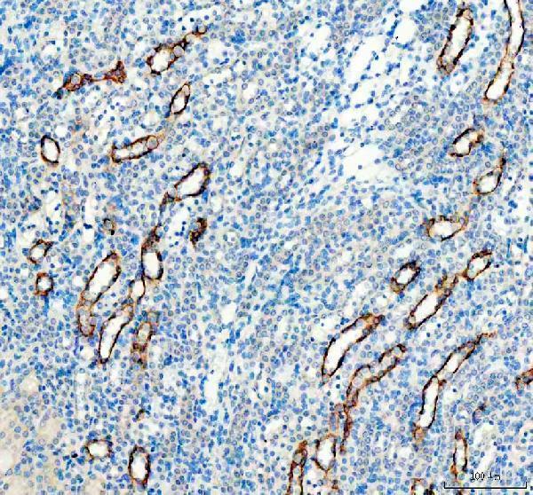 pa1488 aqp3 primary antibodies ihc testing 2_2