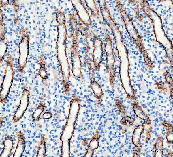 pa1488 aqp3 primary antibodies ihc testing 4_2