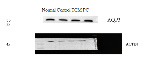 pa1488 aqp3 primary antibodies wb testing 2