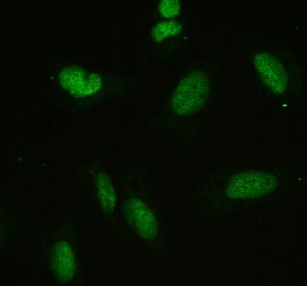pa1494 apex1 primary antibodies if testing 7