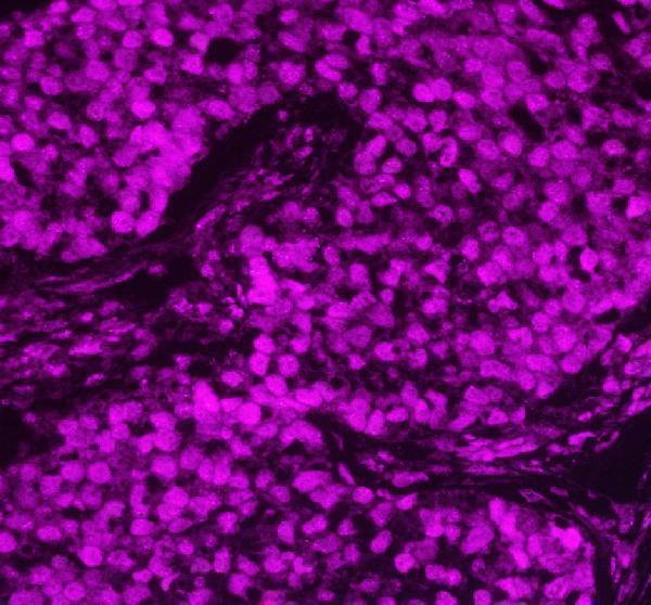 pa1494 apex1 primary antibodies if testing 8