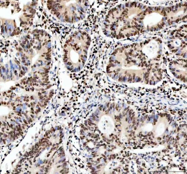  IHC analysis of APEX1 using anti-APEX1 antibody (PA1494)