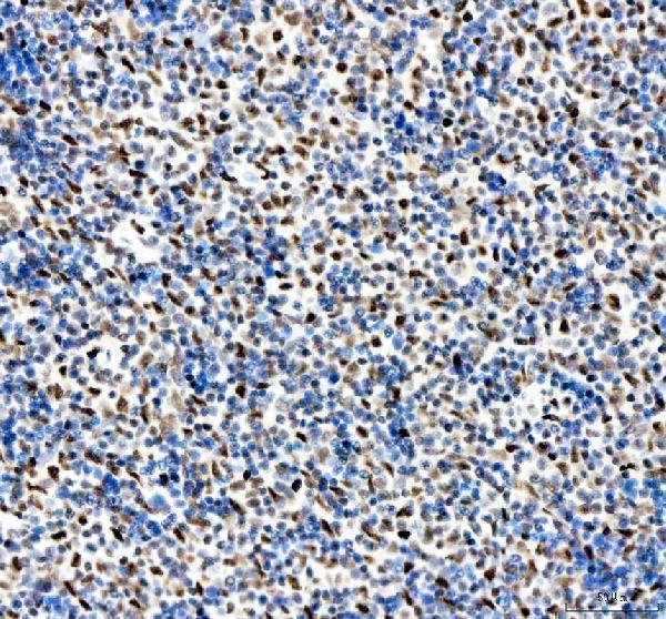 IHC analysis of APEX1 using anti-APEX1 antibody (PA1494)