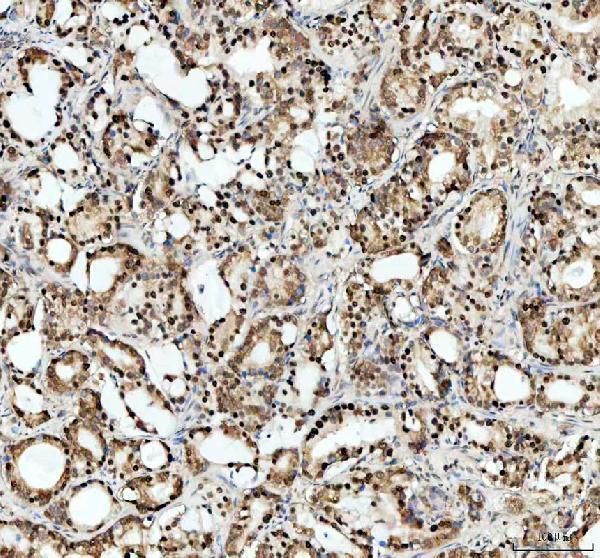 pa1494 apex1 primary antibodies ihc testing 4