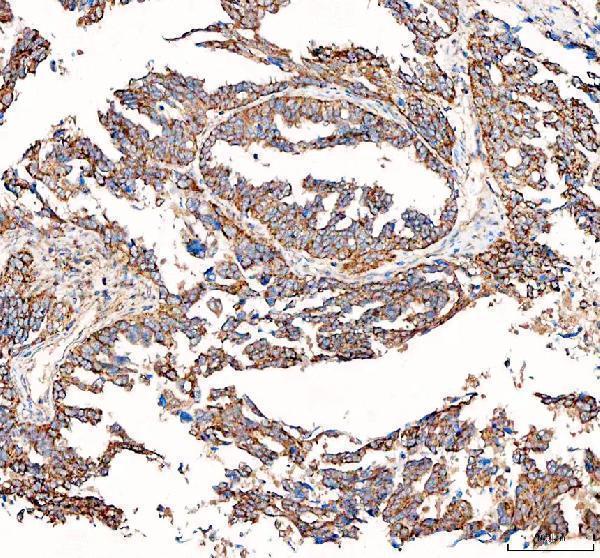 pa1502 bcat2 primary antibodies ihc testing 1