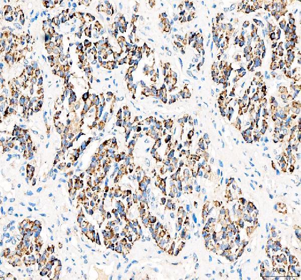 pa1502 bcat2 primary antibodies ihc testing 2