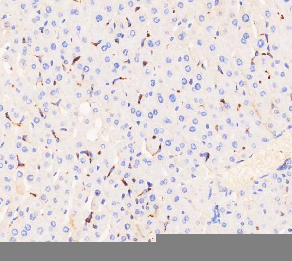  IHC analysis of CD68 using anti-CD68 antibody (PA1518). 