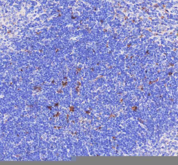  IHC analysis of CD68 using anti-CD68 antibody (PA1518). 