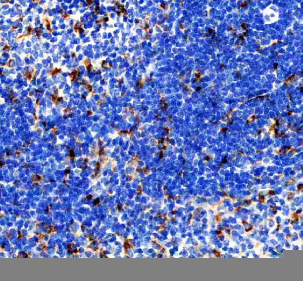  IHC analysis of CD68 using anti-CD68 antibody (PA1518). 