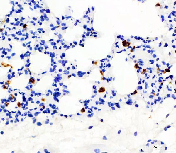  IHC analysis of CD68 using anti-CD68 antibody (PA1518). 