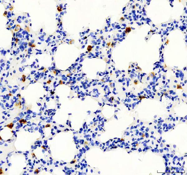  IHC analysis of CD68 using anti-CD68 antibody (PA1518). 