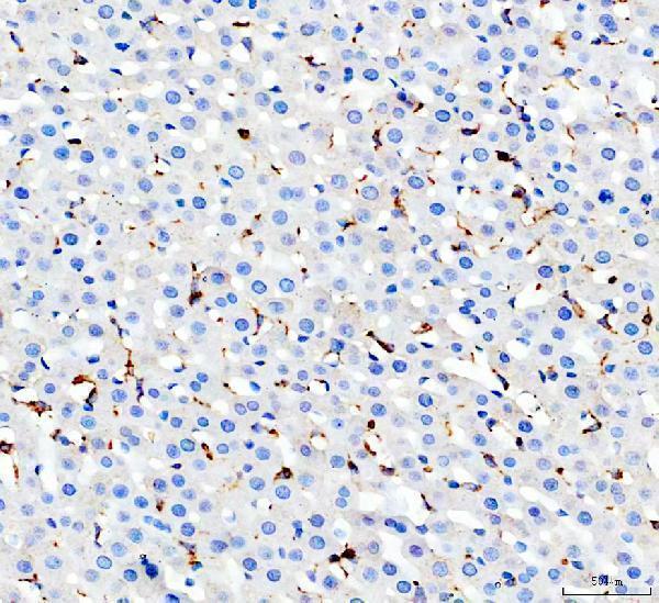  IHC analysis of CD68 using anti-CD68 antibody (PA1518). 