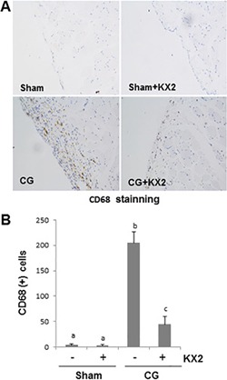 pa1518 oncotarget 08 83872 g009