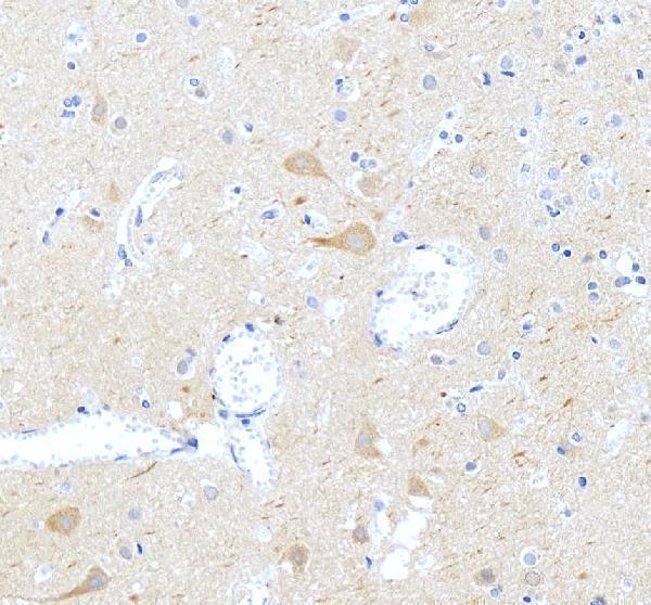 pa1520 camkk1 primary antibodies ihc testing 3