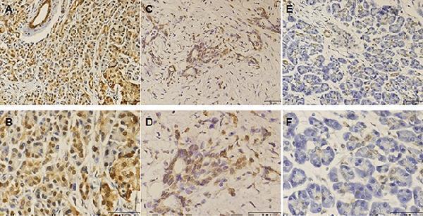 pa1535 oncotarget 07 70092 g004