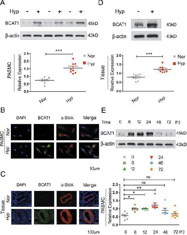 pa1538 41419_2020_2930_fig1_html