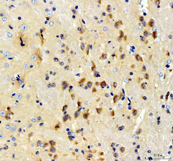 pa1538 bcat1 primary antibodies ihc testing 1