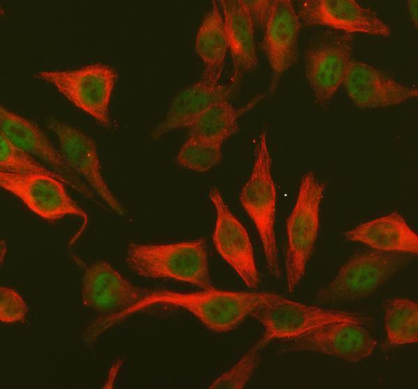 IF analysis of Cdk5 using anti-Cdk5 antibody (PA1548) and anti-Alpha Tubulin antibody (M03989-3)