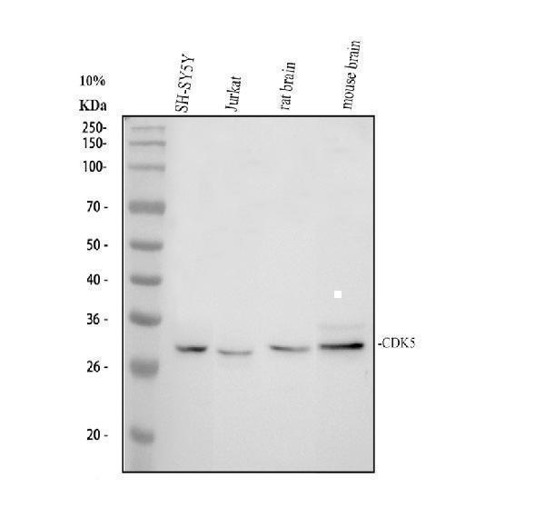 Western blot analysis of Cdk5 using anti-Cdk5 antibody (PA1548)