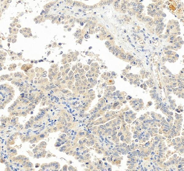 pa1552 lhcgr primary antibodies ihc testing 2