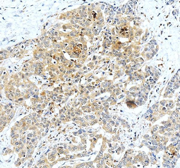 IHC analysis of Gamma Cystathionase/CTH using anti-Gamma Cystathionase/CTH antibody (PA1556)