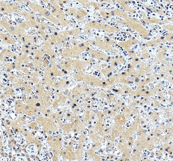 IHC analysis of Gamma Cystathionase/CTH using anti-Gamma Cystathionase/CTH antibody (PA1556)