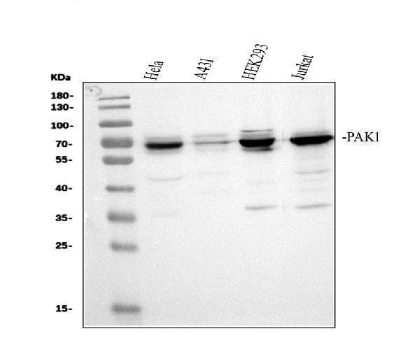 pa1563 pak1 primary antibodies wb testing 1