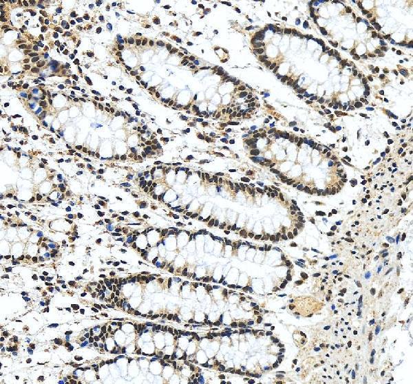 pa1570 ctbp1 primary antibodies ihc testing 3