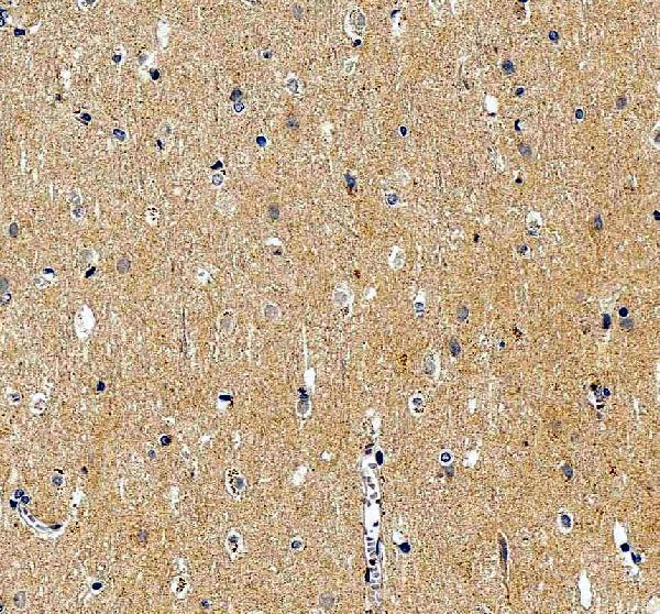 IHC analysis of GABRA1 using anti-GABRA1 antibody (PA1578)