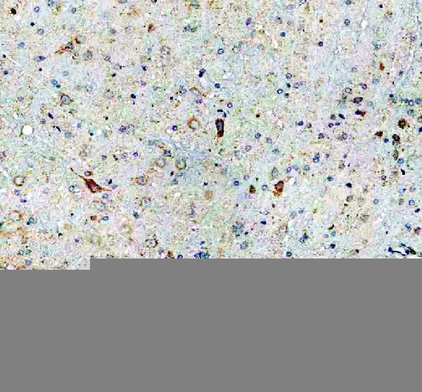 pa1584 drd3 primary antibodies ihc testing 1