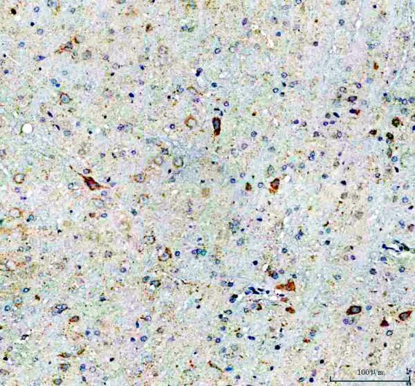 pa1584 drd3 primary antibodies ihc testing 1_1