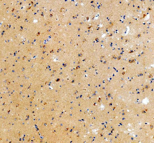 pa1584 drd3 primary antibodies ihc testing 2