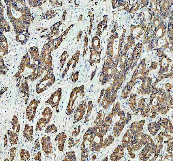 IHC analysis of GRB7 using anti-GRB7 antibody (PA1589-1)