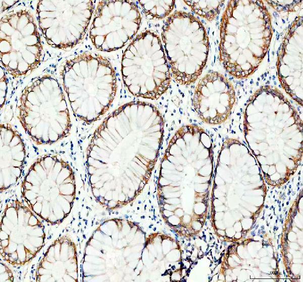 IHC analysis of GRB7 using anti-GRB7 antibody (PA1589-1)