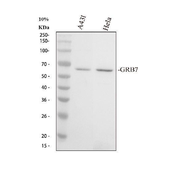 Western blot analysis of GRB7 using anti-GRB7 antibody (PA1589-1)