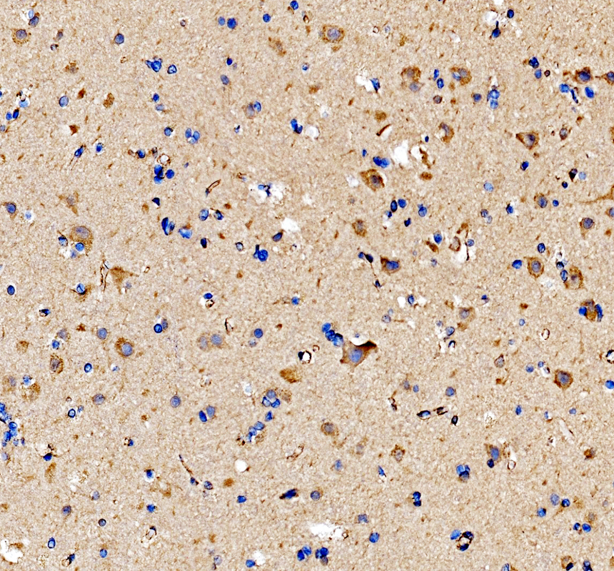 IHC analysis of DNAJA1 using anti-DNAJA1 antibody (PA1597)