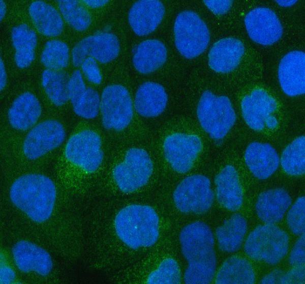 pa1621 itga3 primary antibodies if testing 4_1