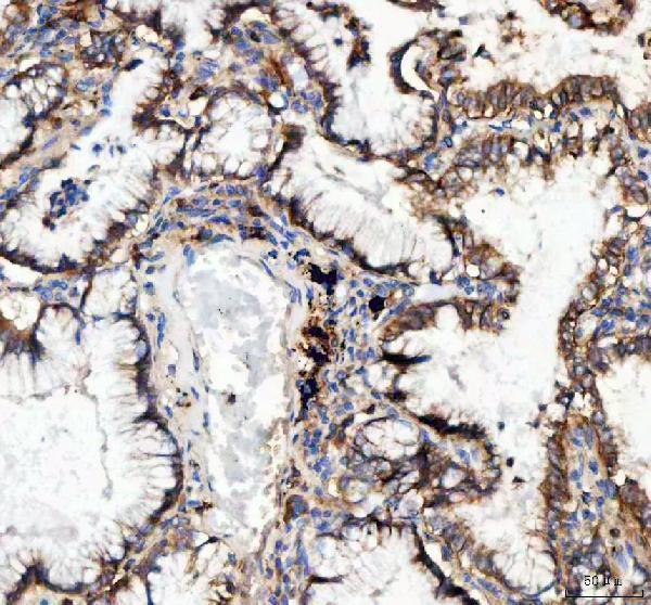 pa1621 itga3 primary antibodies ihc testing 2