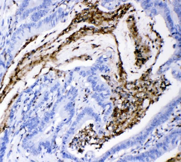  IHC analysis of CD18/ITGB2 using anti-CD18/ITGB2 antibody (PA1623)