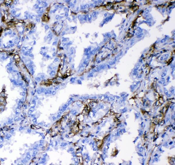  IHC analysis of CD18/ITGB2 using anti-CD18/ITGB2 antibody (PA1623)
