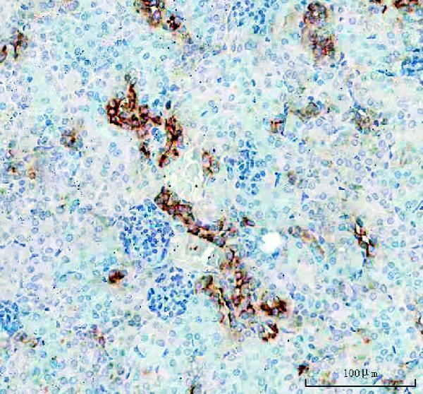 pa1632 havcr1 primary antibodies ihc testing 1