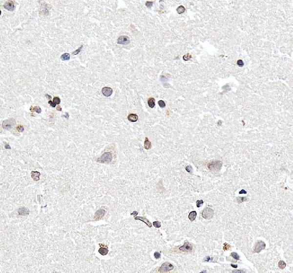 pa1636 lmnb2 primary antibodies ihc testing 4