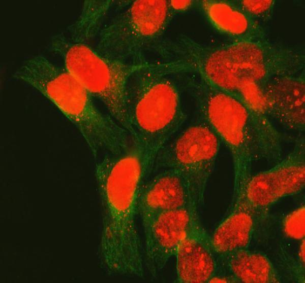 pa1639 xrcc1 primary antibodies if testing 4