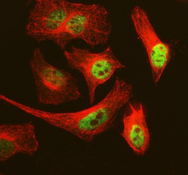 pa1642 mcm3 primary antibodies if testing 5