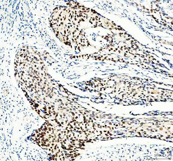 pa1642 mcm3 primary antibodies ihc testing 2