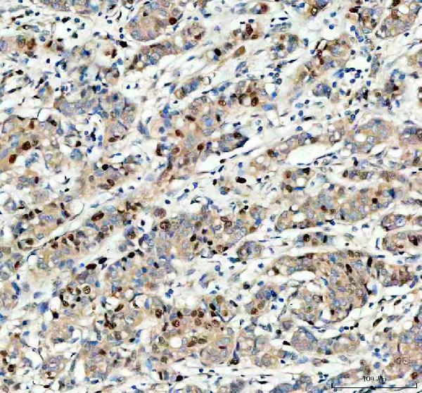 pa1642 mcm3 primary antibodies ihc testing 3
