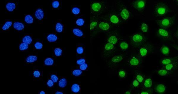pa1642 xrcc6 primary antibodies if testing 5