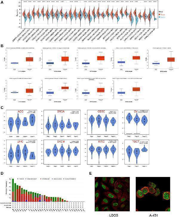 Expression patterns of MCM3 in pan-cancer